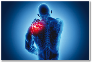 3D illustration, shoulder painful skeleton x-ray, medical concept.