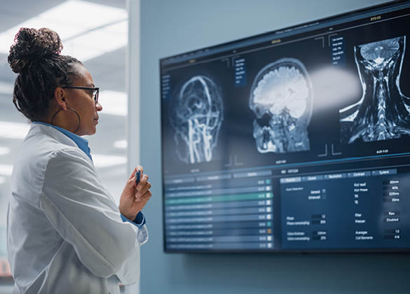 Medical Science Hospital: Confident Black Female Neurologist, Neuroscientist, Neurosurgeon, Looks at TV Screen with MRI Scan with Brain Images, Thinks about Sick Patient Treatment Method. Saving Lives