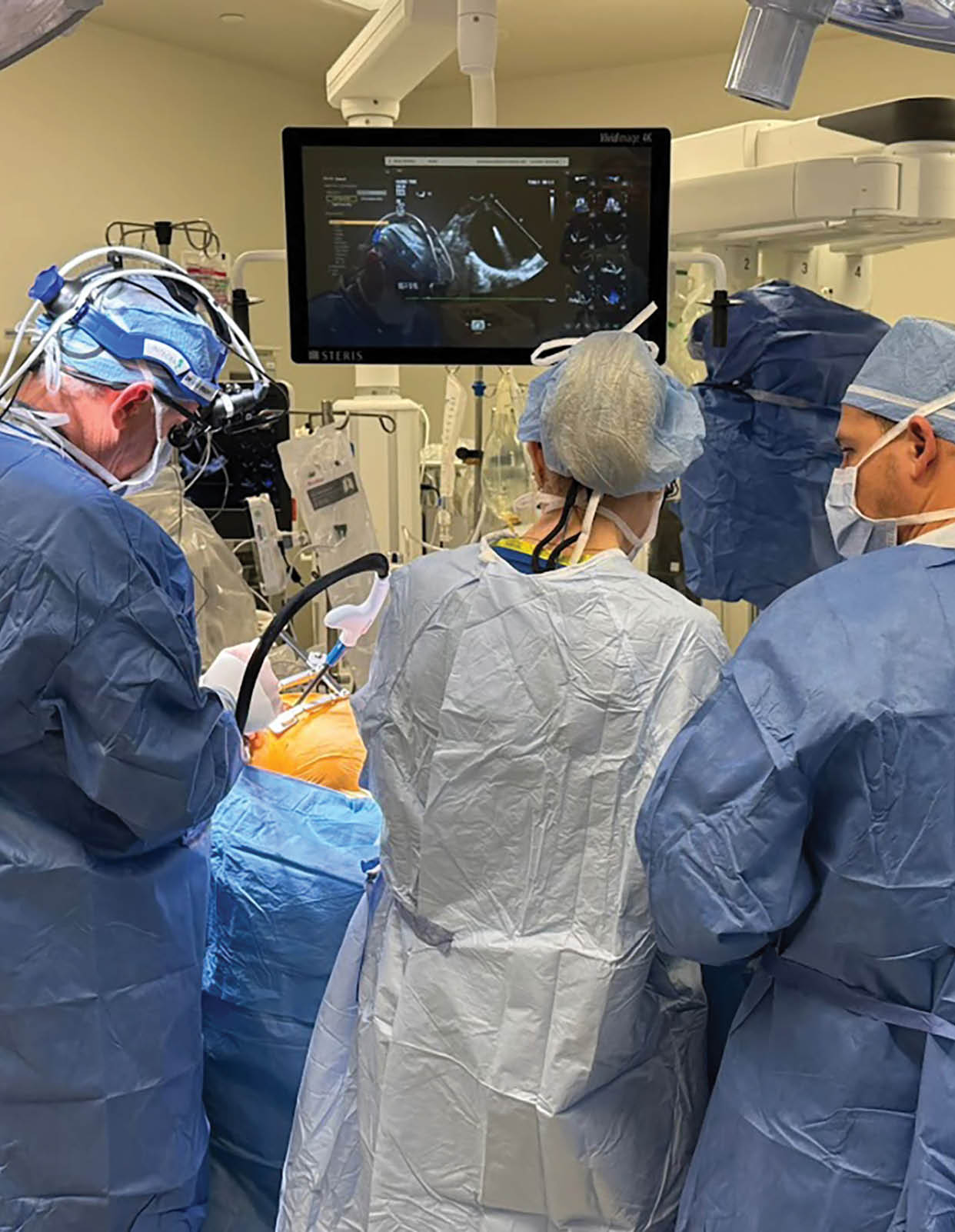 A group of doctors wearing blue scrubs are gathered around a patient in a hospital room. They are looking at a monitor, possibly discussing the patient's medical condition. AI generated content